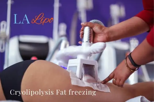 women getting fat freezing Deanshanger