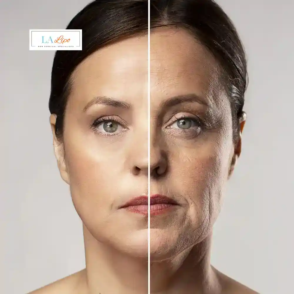 How Can You Tell If Non-Surgical Skin Tightening Is Right for You Deanshanger?