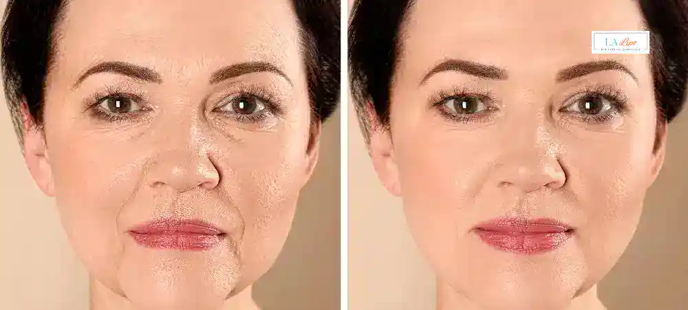 Why Aren’t My Skincare Products Making My Sagging Skin Look Firmer Deanshanger?