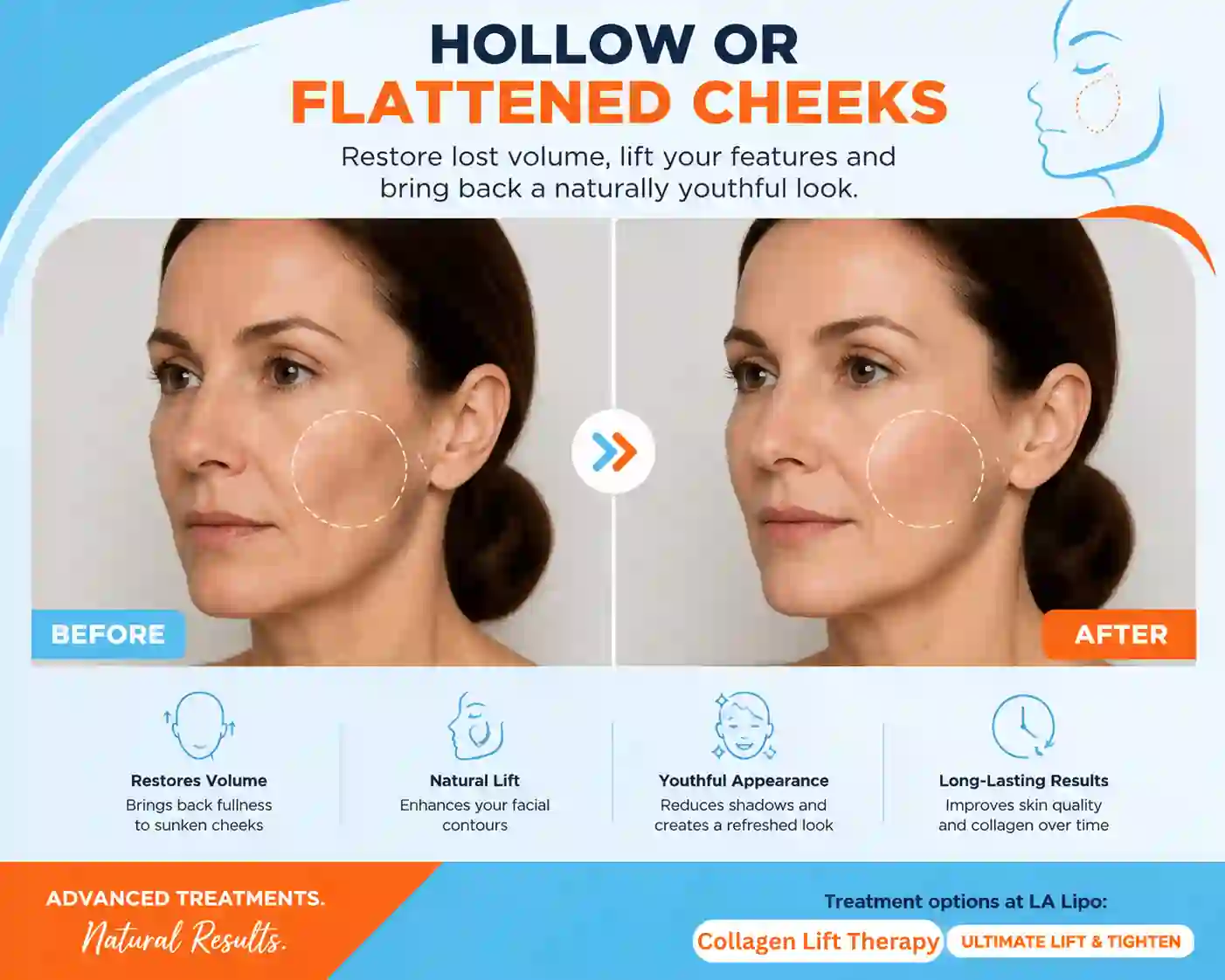 Sign #4: Hollow or Flattened Cheeks Deanshanger