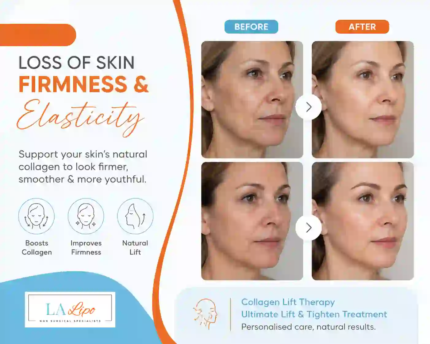 Sign #7: Loss of Skin Firmness and Elasticity Deanshanger